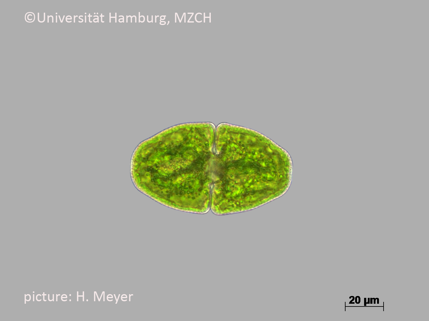 572_Cosmarium pyramidatum_400x-27_H. Meyer.bmp